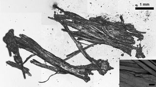 Two large bundles of muscle fibers from animal meat were found in Ötzi's gastrointestinal (GI) tract.
