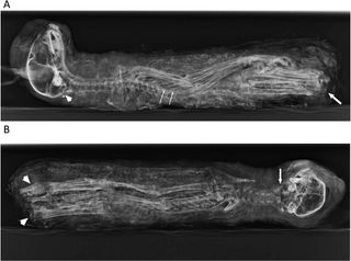 A side and front-on X-ray of the cat mummy.