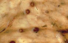 encysted small redworms in horses