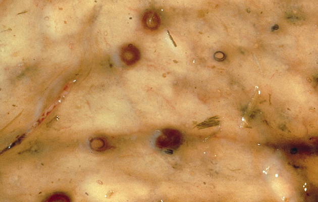 encysted small redworms in horses