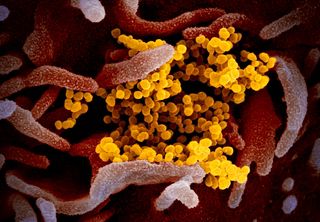 This scanning electron microscope image shows SARS-Cov-2 (yellow) among human cells (pink). This virus was isolated from a patient in the U.S.