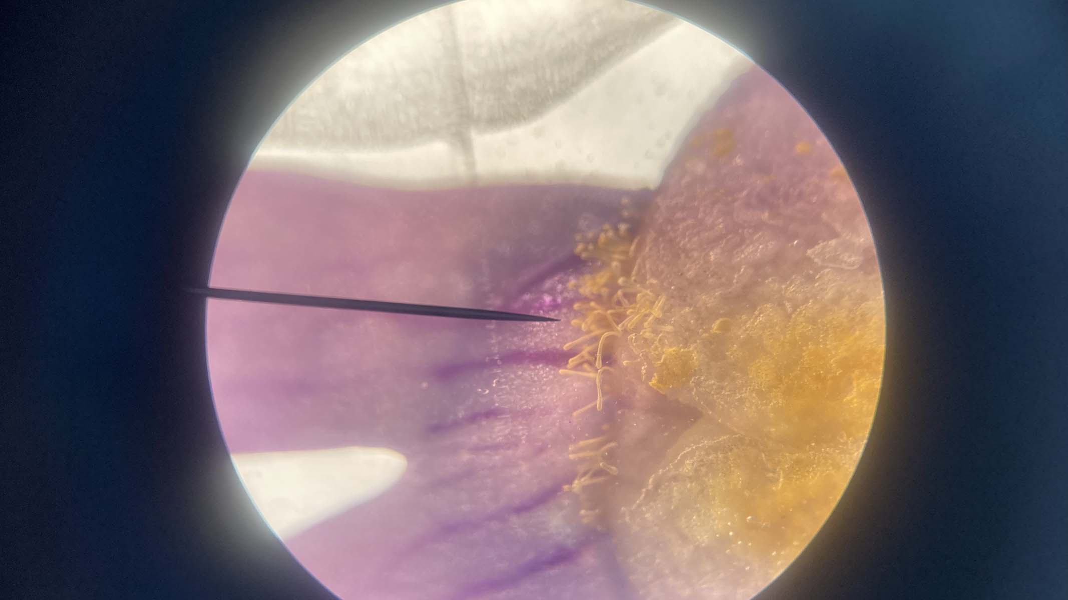 photographing a microscope specimen