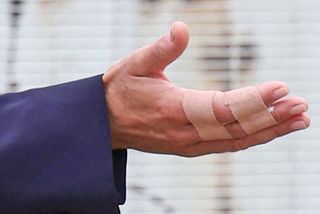 Kate Middleton fingers strapped up with plasters after she injured herself trampolining