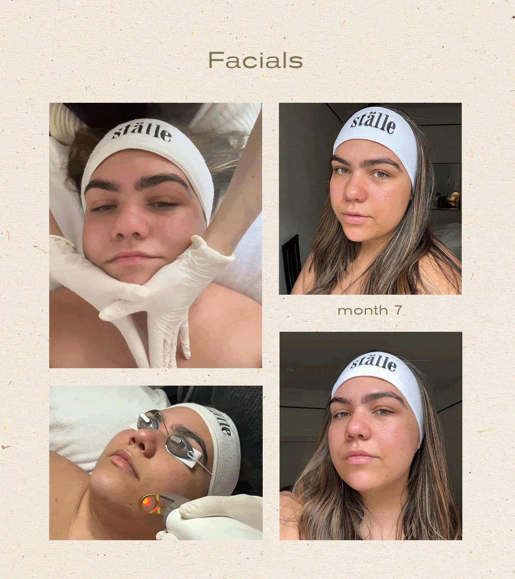Photos of editor Ana Escalante and her skincare routine and progress photos throughout her engagement skincare process.