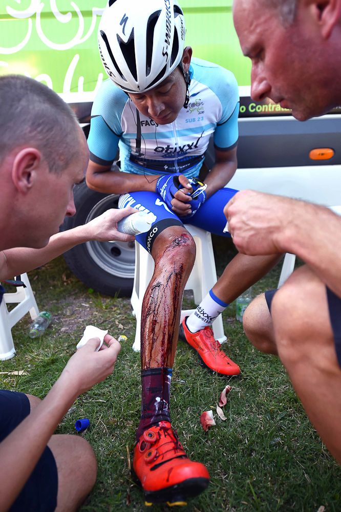 Rodrigo Contreras' knee was badly injured in the stage 5 crash.