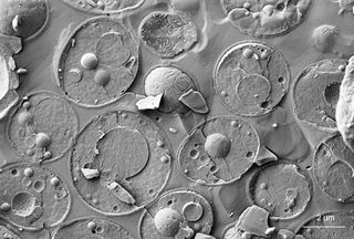 Freeze fractured electronic microscopic images of Baker’s yeast.