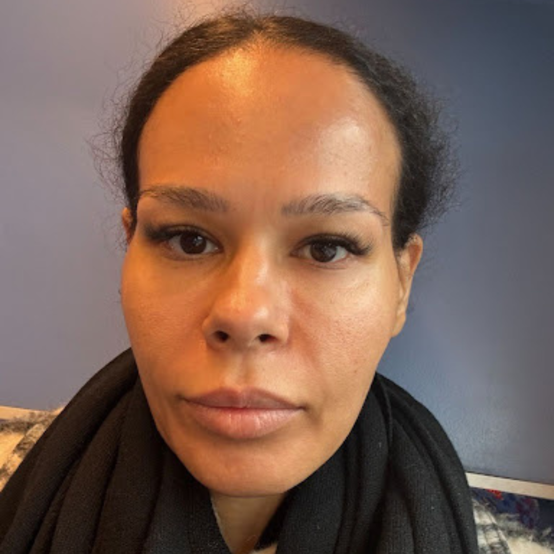 Amerley Ollennu noticed skin changes after taking GLP-1s