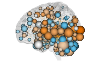 Spheres represent regions of the brain and lines show the connections between them. The size of the spheres corresponds to the number of connections they have. Orange spheres have more connections in the network that predicts better attention, blue spheres have more connections in the network that predicts worse attention, and gray spheres have an approximately equal number of connections in each.