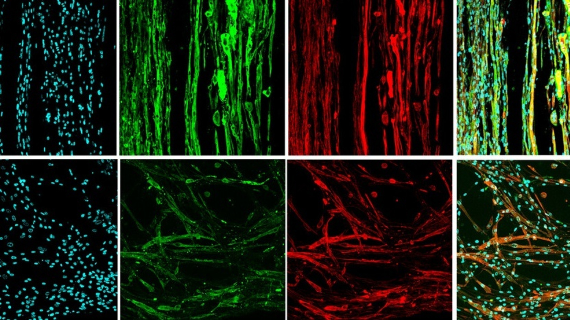 A series of 8 boxes showing various cell types with some blue tinted, some green tinted, and some red tinted