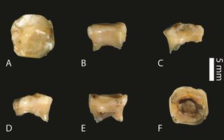 Scientists say the molar tooth found in Denisova Cave in Siberia estimate the tooth is at least 20,000 years older than previously examined Denisovan fossils.