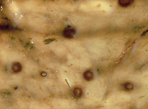 EncystedSmallRedworms.jpg