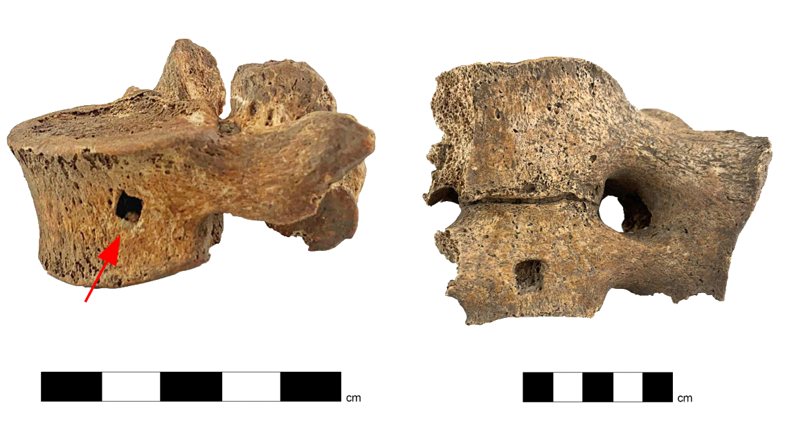 two human bones against a white background