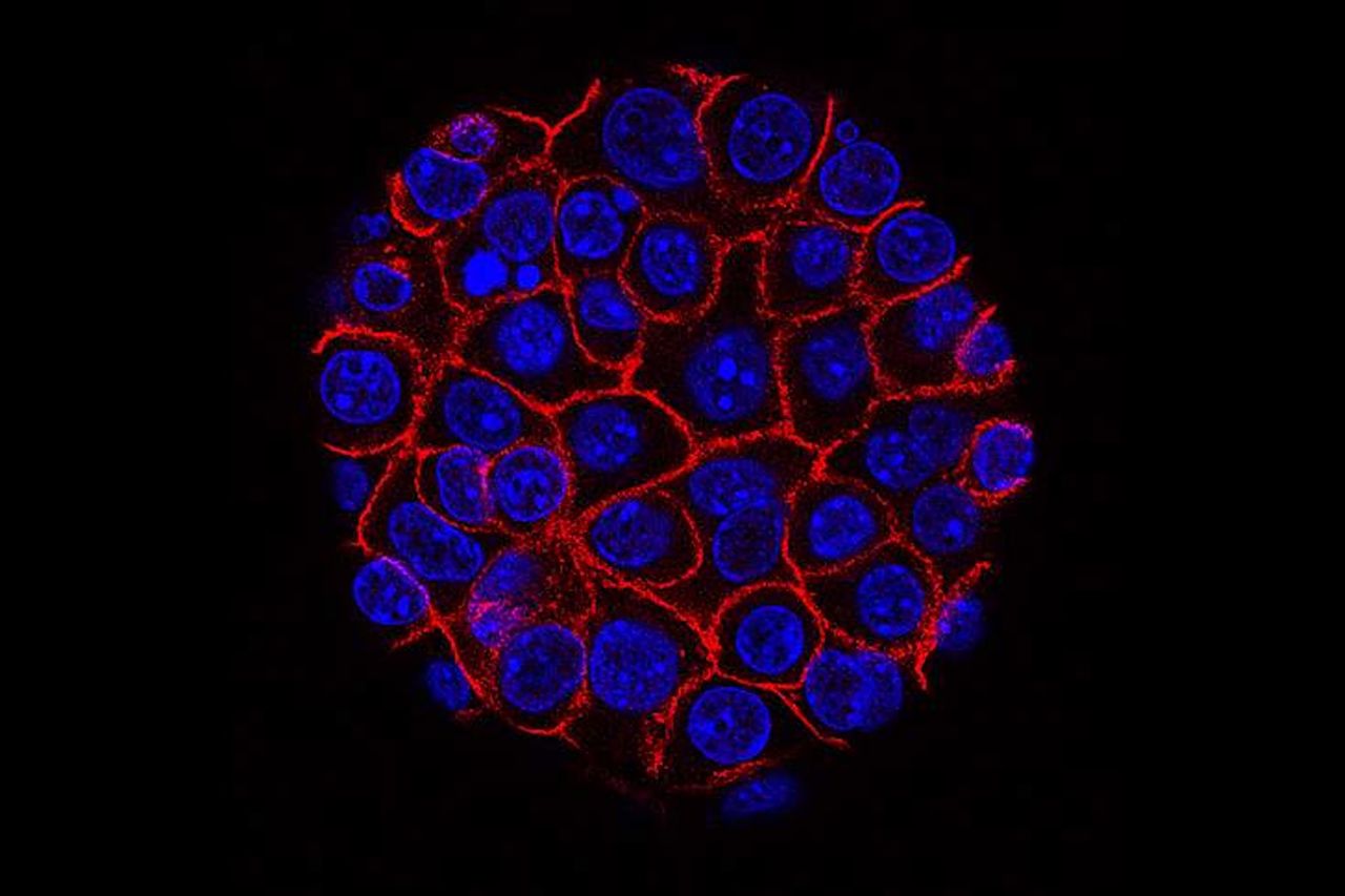 A sphere made of smaller blue spheres inside red membranes, against a black background