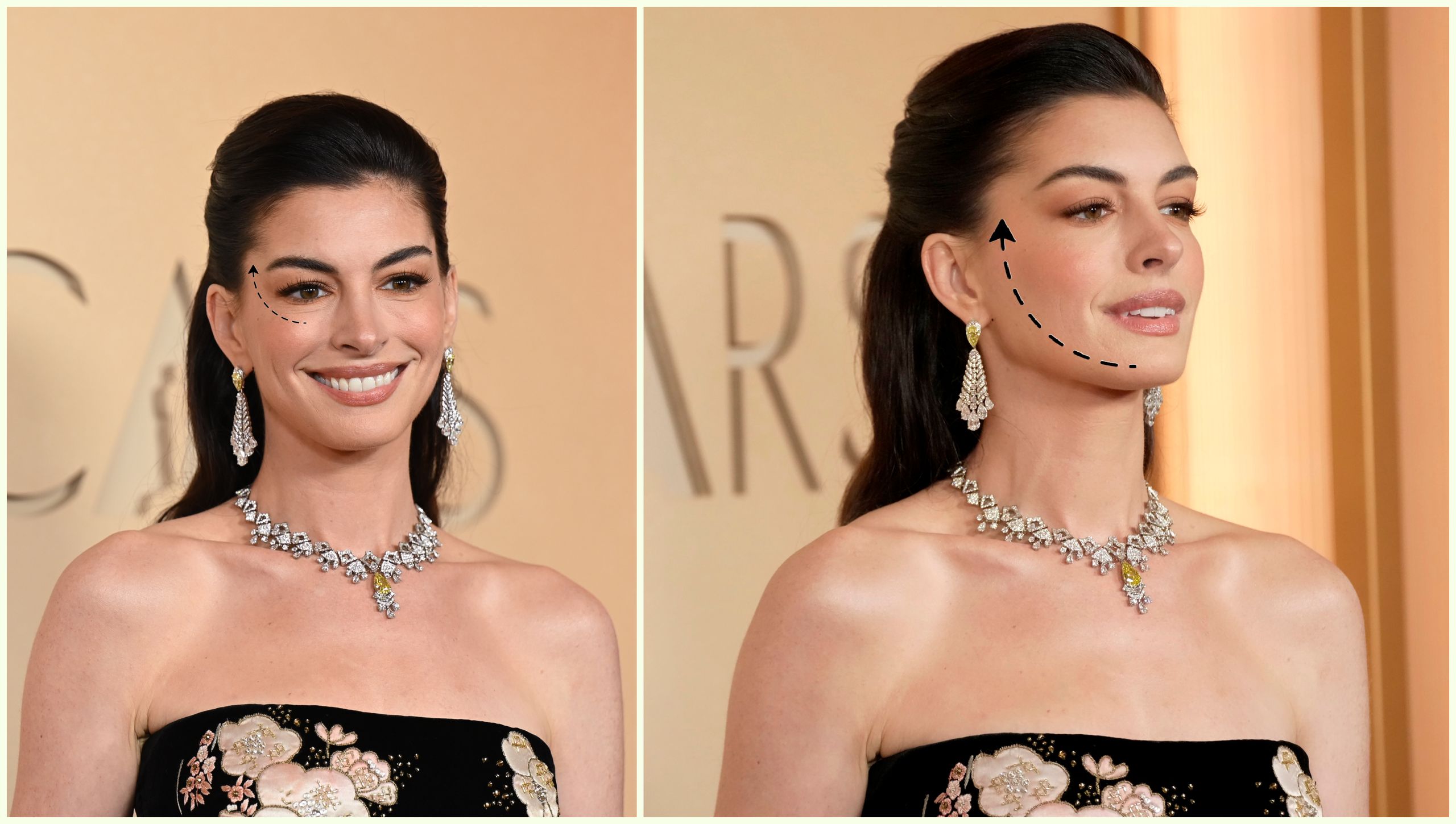 I Stole Anne Hathaway's Facelift Hair Hack—Now My Jawline Is Snatched