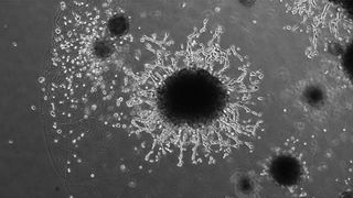 microscopic black and white image shows a cluster of dark cells at the center; these cells make up a placental organoid