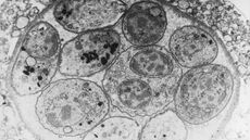 A Toxoplasma gondii tissue cyst.