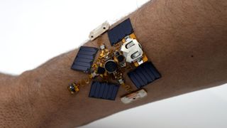 This lifesaving patch buzzes your arm when it detects nearby poisons