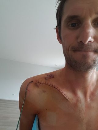 Frank Schleck after his collarbone surgery