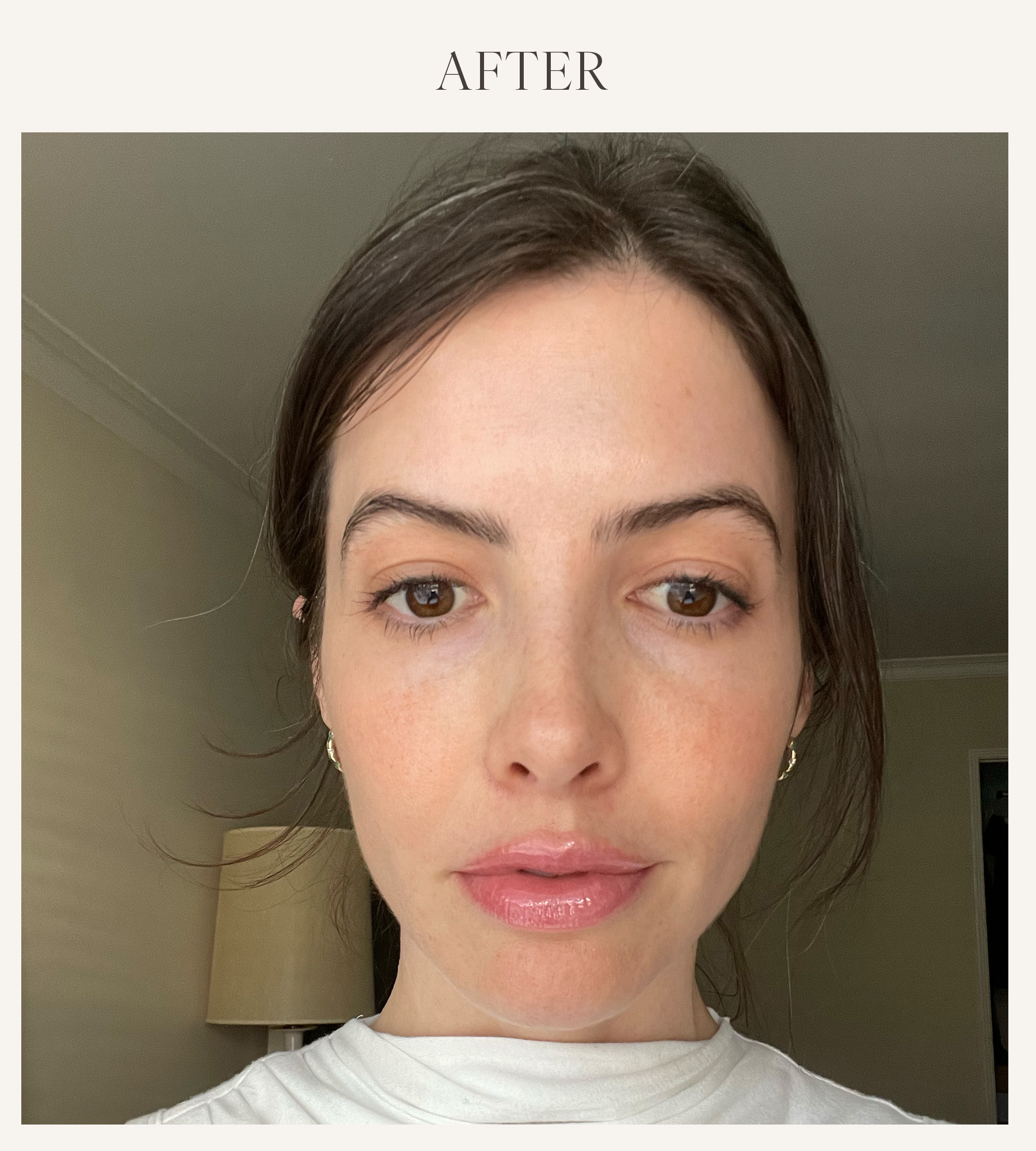 After photo of Kat Collings testing the Grande Cosmetics lip plumper 