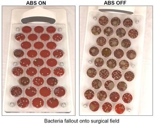 The ABS system can reduce the number and size of bacterial colonies that grow on a nutrient rich broth in the lab.