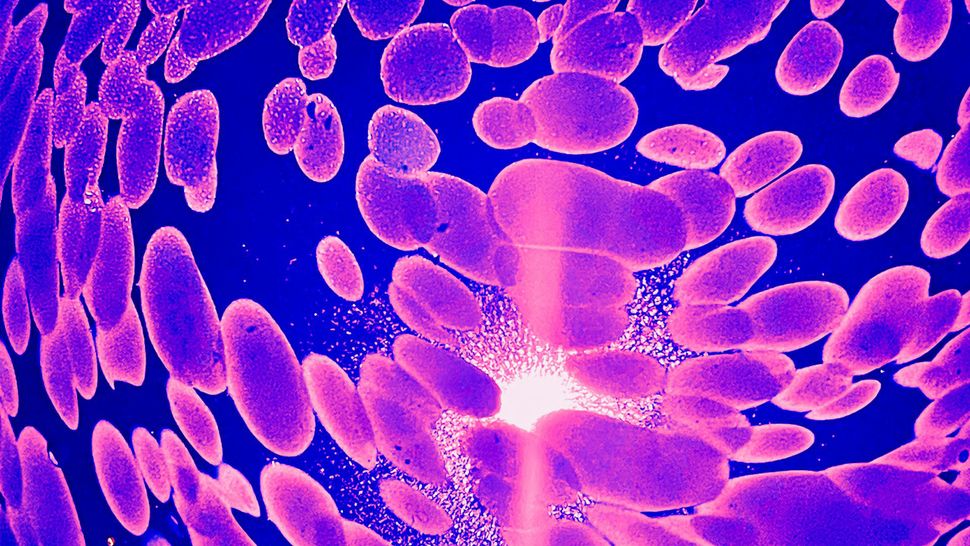 Cancer patients can now be 'matched' to best treatment with DNA and lab