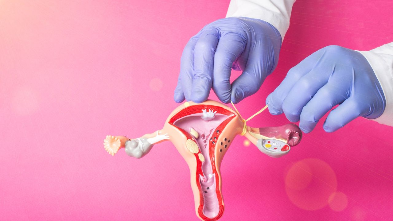 gynecologist ties the fallopian tubes on the model of the female reproductive system, pink background