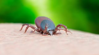 A tick biting human skin