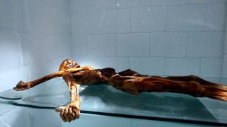 The mummy of Ötzi the Iceman.