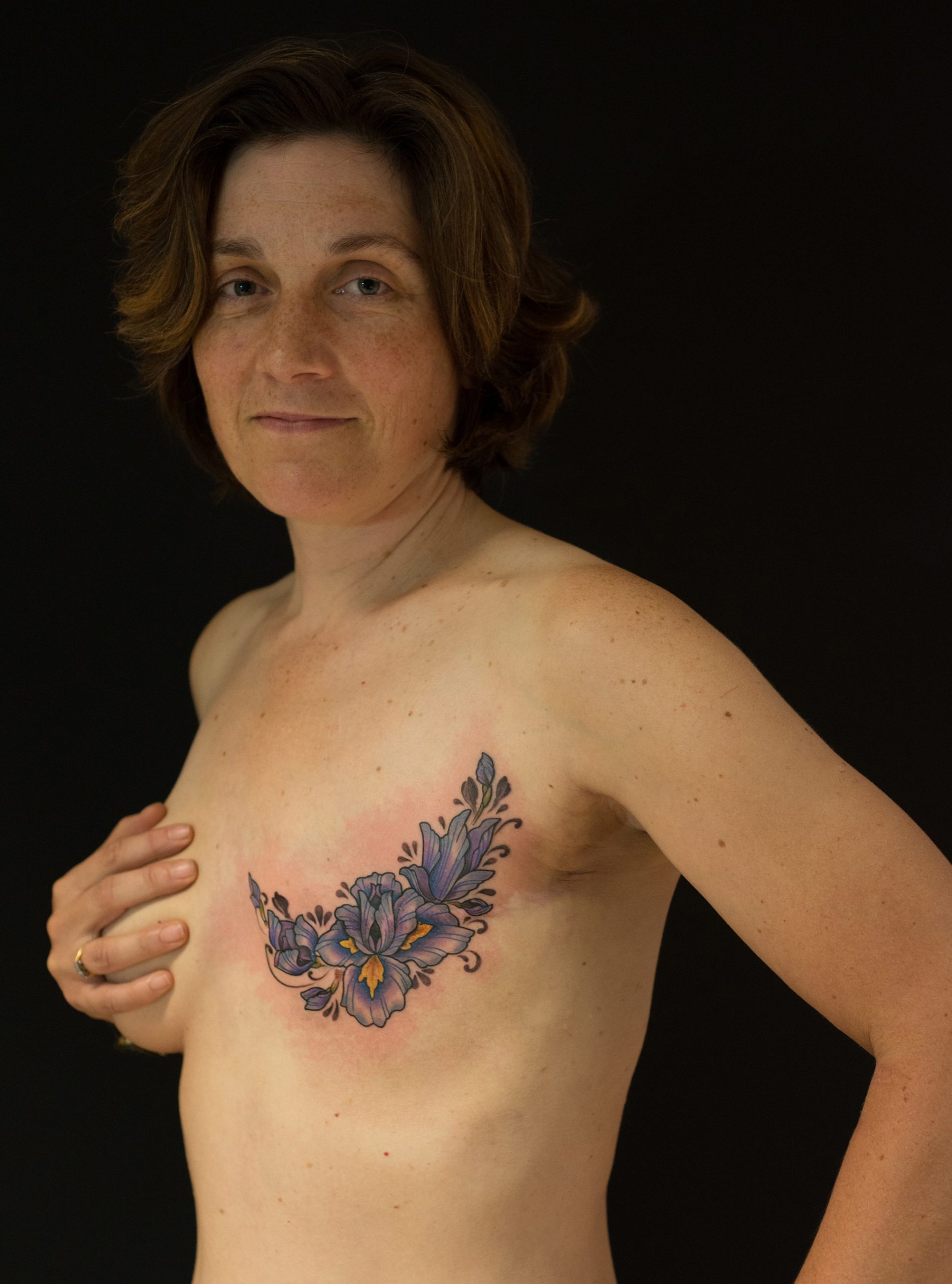 Beautiful' tattoos cover breast cancer scars