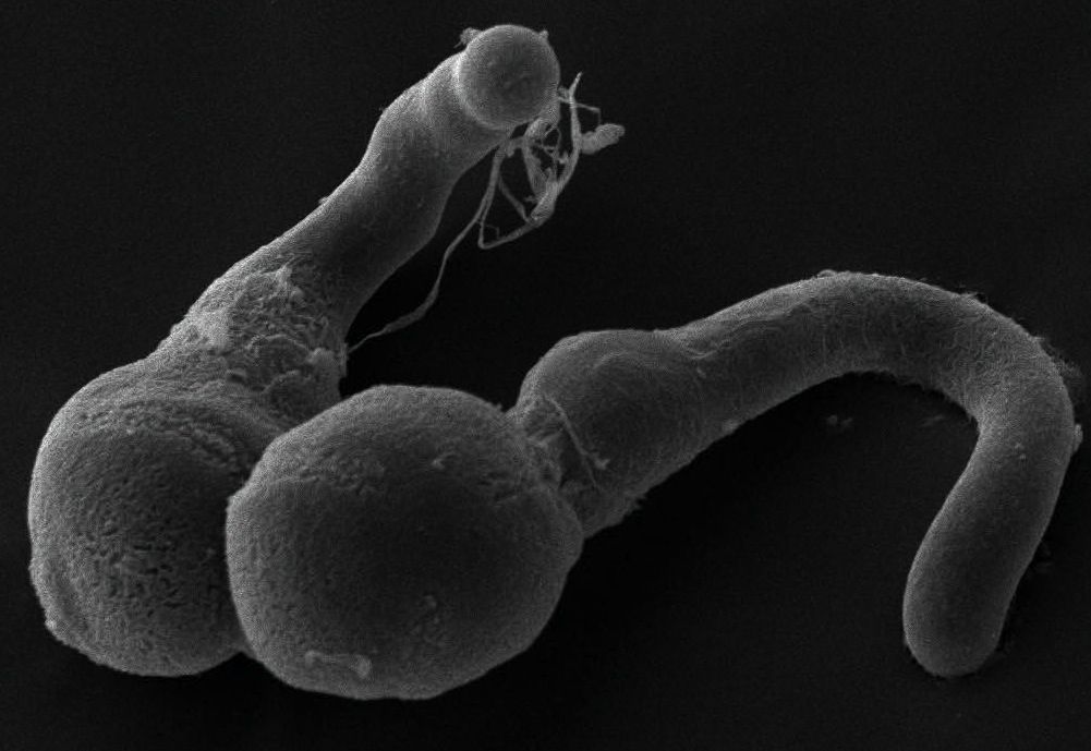 plant-parts-release-sperm-when-squeezed-plant-sex-live-science