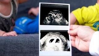 hand holding an ultrasound scan of twins in a womb; in the background, two infants can be seen sitting