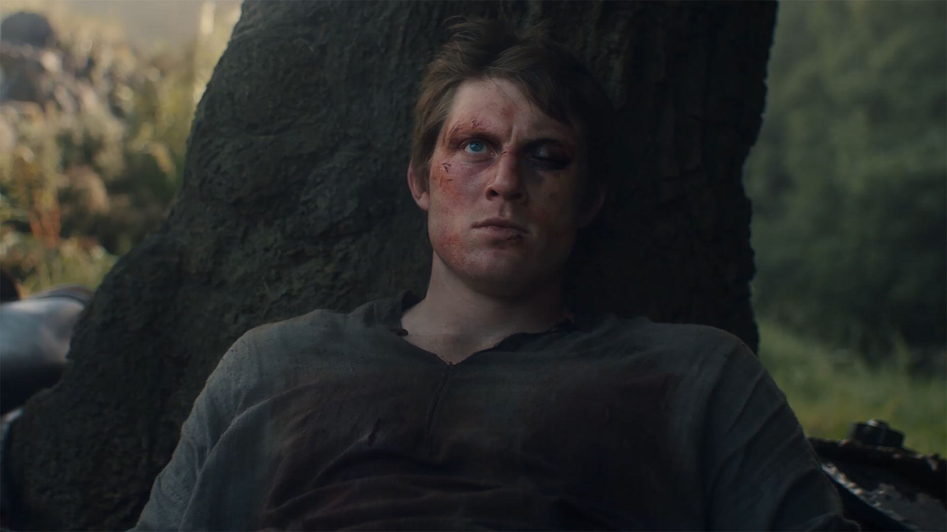 An injured Dunk scowling as he sits leaning against a tree in A Knight of the Seven Kingdoms' season 1 finale