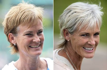 Judy Murray's teeth before and after