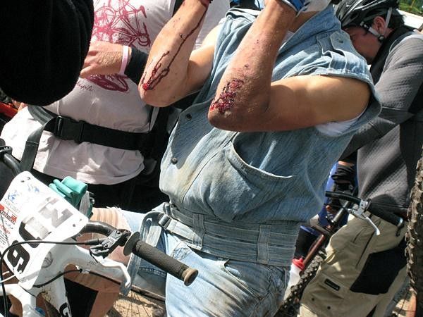 Clad in denim, Adam Craig (Team Giant) shows off his dirt rash after the main race event.