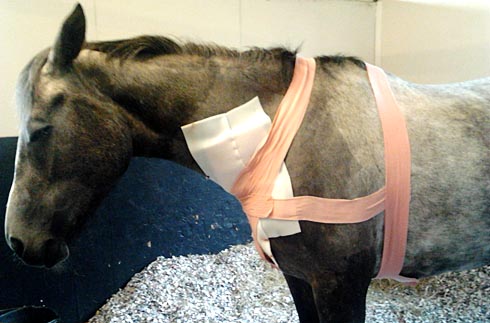 after-first-surgery.jpg