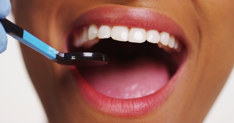 A woman smiles, revealing her teeth.