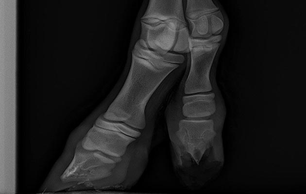 X-ray-fifth-digit