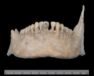 Some of the skulls discovered in a mass grave in the Classic Maya city Uxul featured tooth incrustations with jade, a symbol of high status due to the material's scarcity. The jade would have been placed in cavities purposely drilled into these teeth.