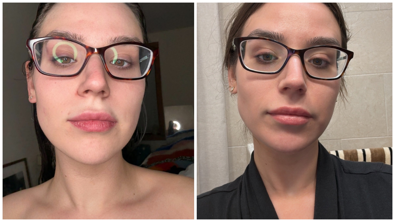 Siena Gagliano before and after the 111 Skin Exosome Face Lift Duo in a black robe and glasses.