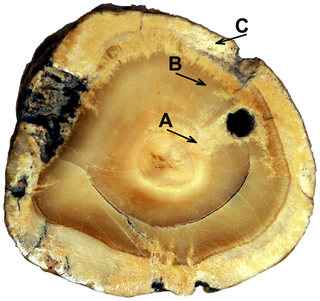 In this cross section of the bladder stone, the letters mark the spots where the researchers conducted chemical analyses. Their results showed that the diet of the affected individual consisted of very acidic foods.