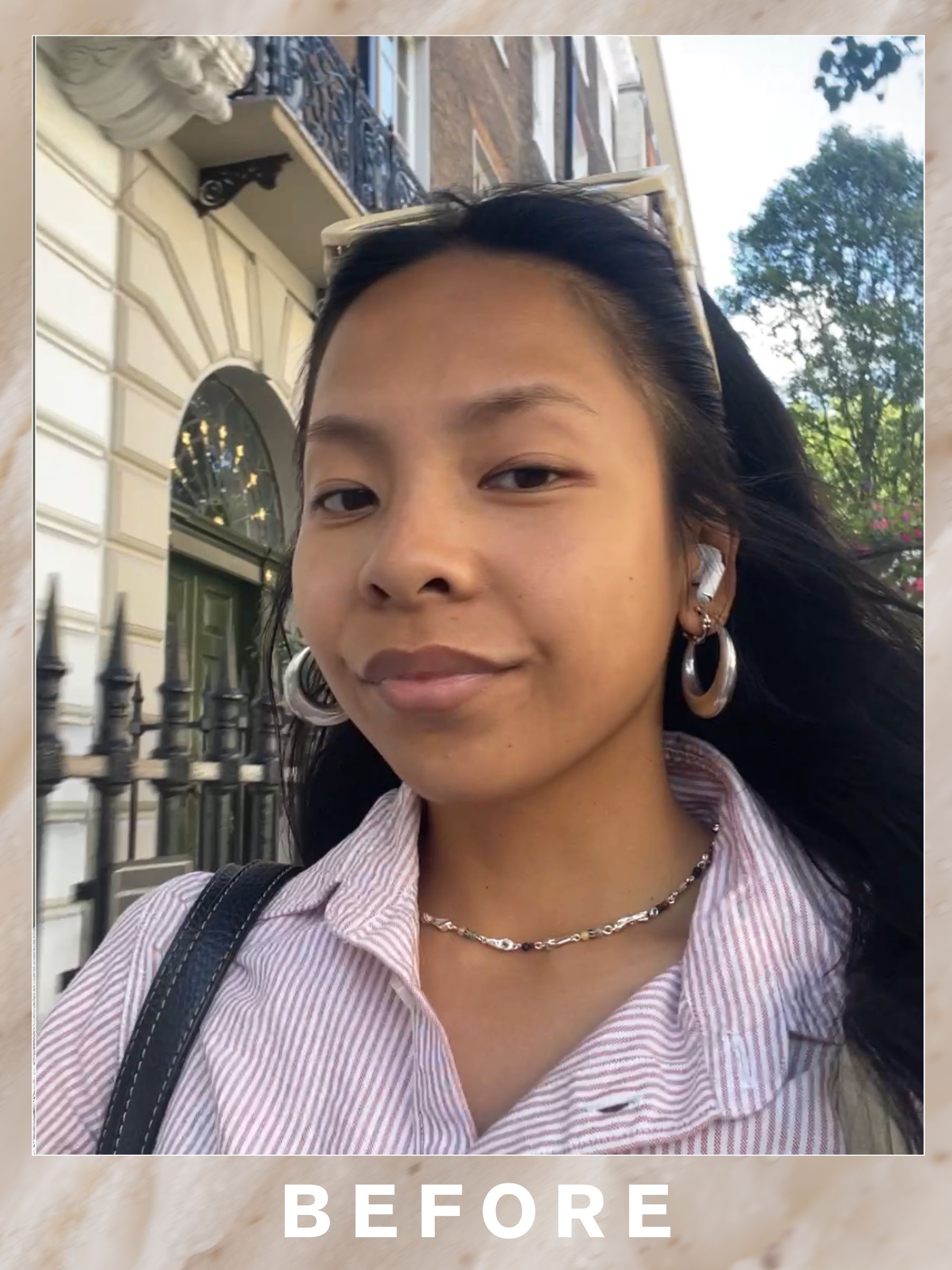 Jerrylyn before her 111Skin Regenerative Facial