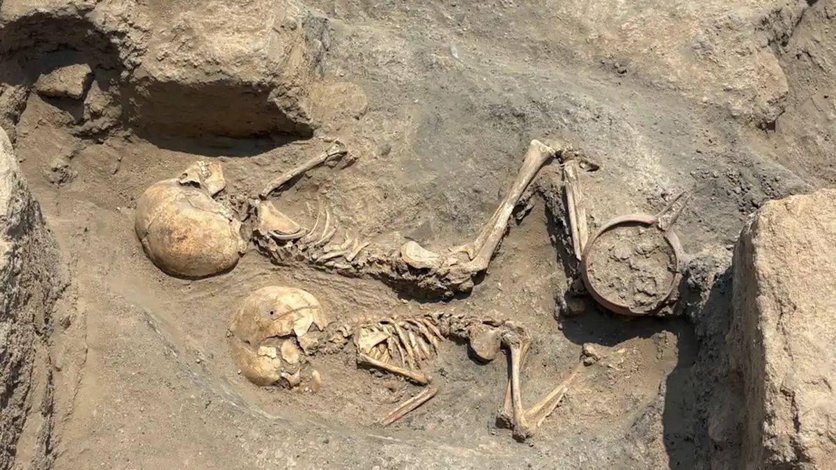 Bronze Age 5-year-old's skull found in Uzbekistan is the oldest known evidence of surgery in Central Asia | Live Science