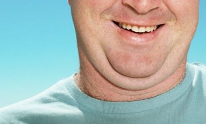 If drug trials go well, you may soon be able to "shrink" your double chin with 40-70 injections of ATX-101, administered over a period of weeks.