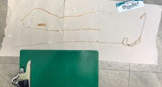 A man in Fresno, California removed a 5-foot long tapeworm from his body. Above, the whole tapeworm laid out on the floor.