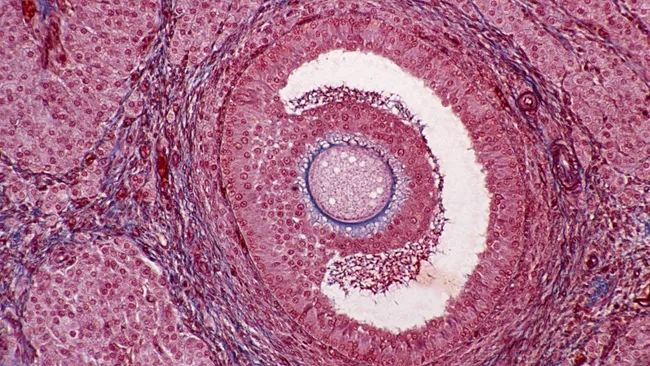 Un corte histológico de un folículo ovárico visto al microscopio. En el centro se observa el ovocito, rodeado por varias capas de células que conforman el folículo. Alrededor del ovocito se encuentra el espacio lleno de líquido conocido como antro folicular, delimitado por las células de la granulosa. La estructura en su conjunto refleja el entorno en el que el ovocito madura antes de la ovulación. Los detalles celulares están teñidos en tonos de rosa y púrpura, permitiendo una clara visualización de las diferentes capas y componentes celulares del folículo.