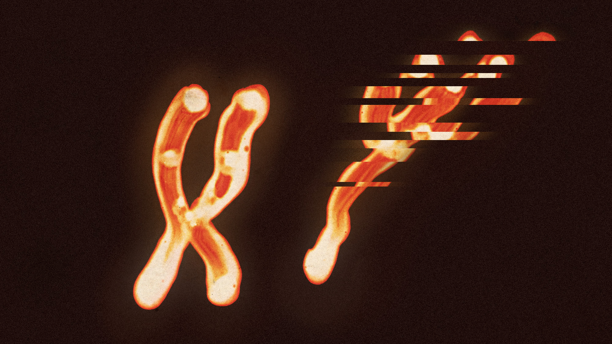 Photo collage of the X and Y chromosome micrograph. The latter is disintegrating.