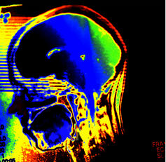 The key question for assessing the benefits of brain training is the generaliszability of benefits.