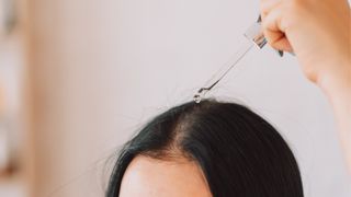 A woman is pictured applying serum to her scalp
