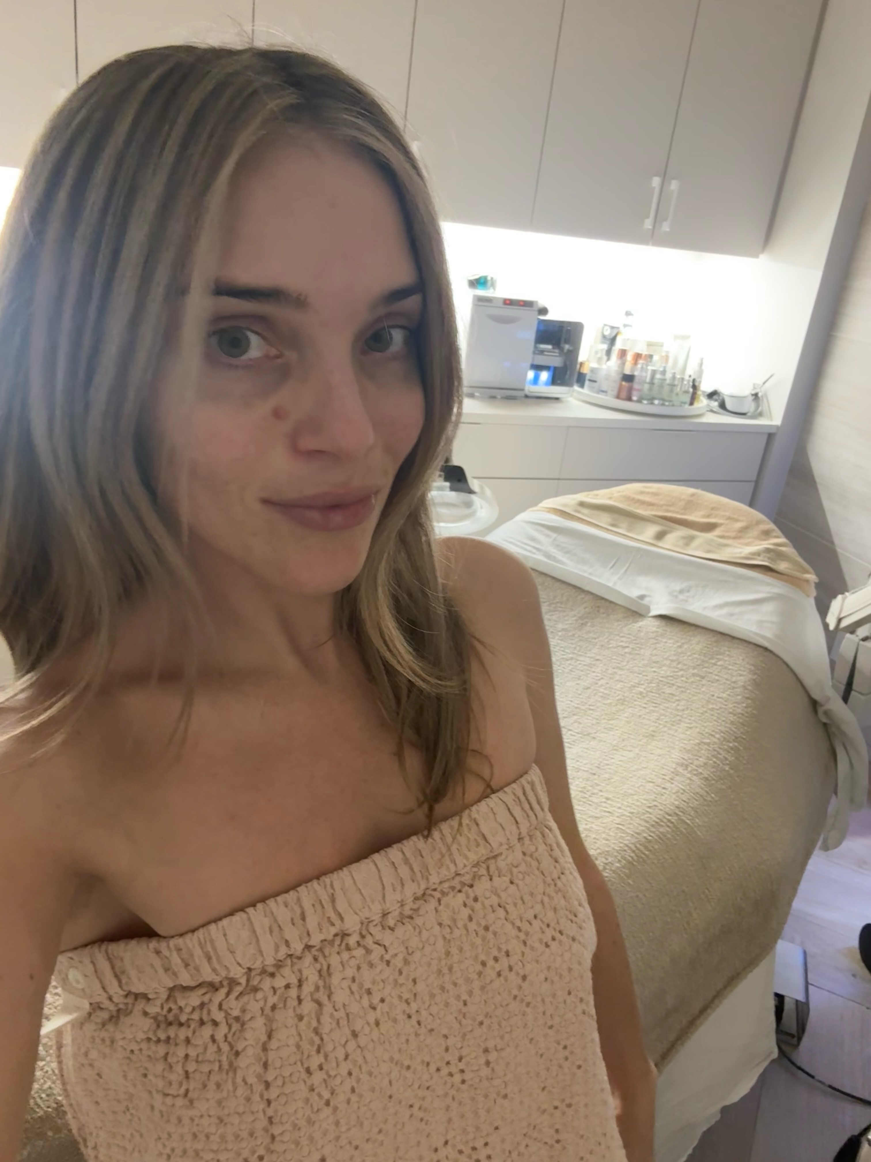 amy louise bailey before, directly after, and 30 minutes after her clear and brilliant