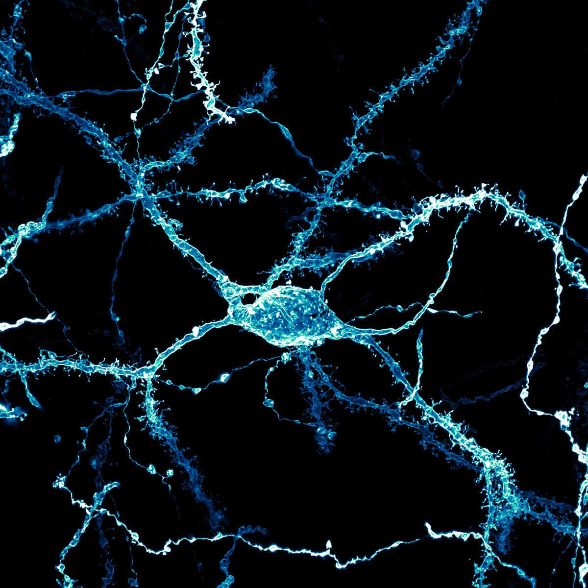 Entrant to the Nikon Small World Photomicrography Competition